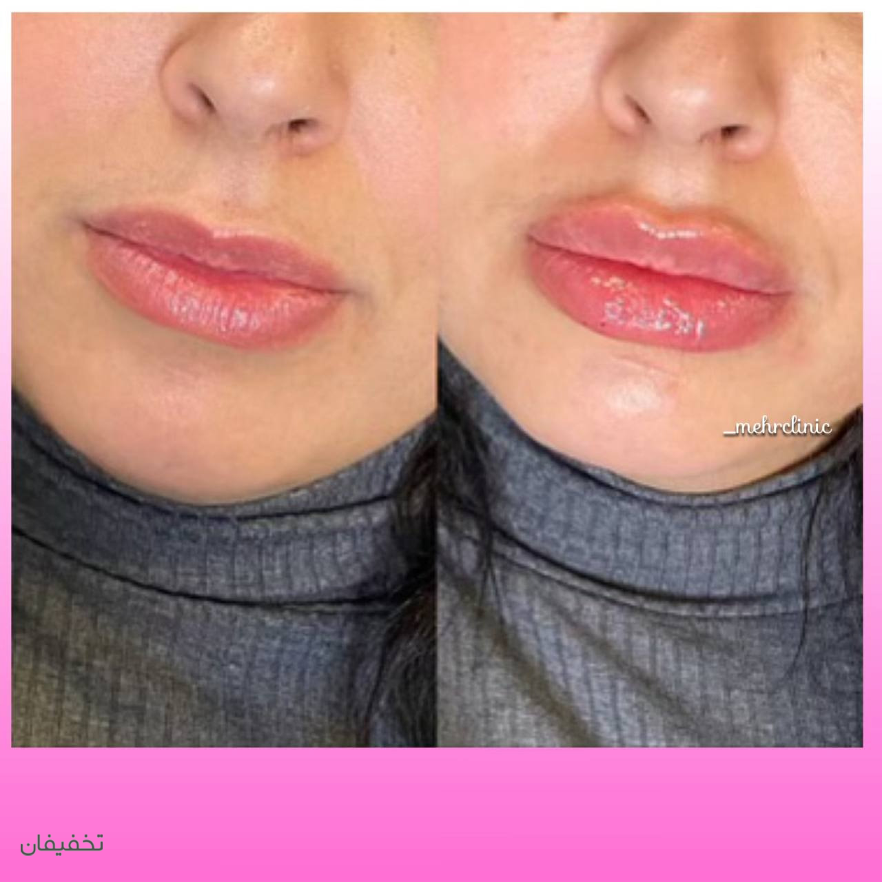 مرکز لاغری و زیبایی مهر