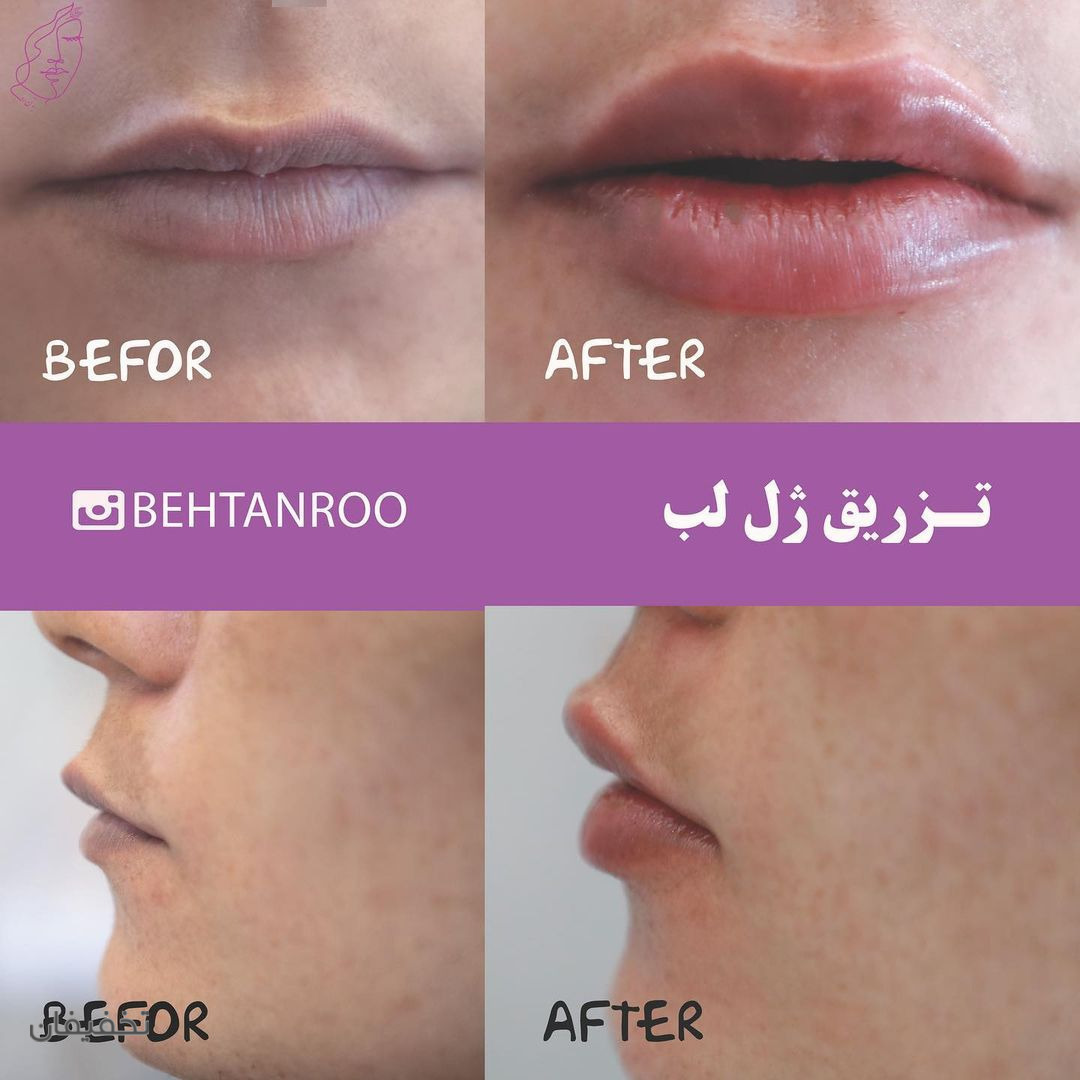 مرکز پوست،مو و لیزر به تن رو