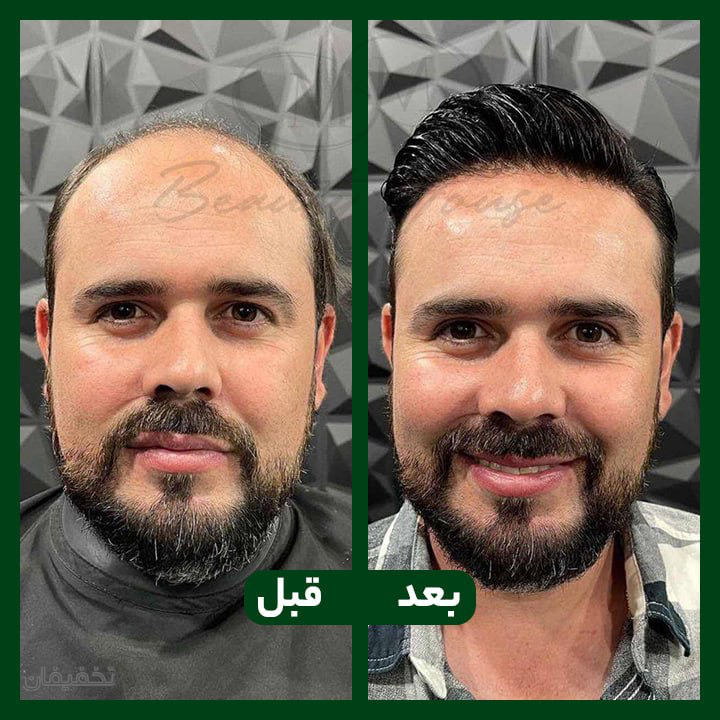 مطب زیبایی ماندگار