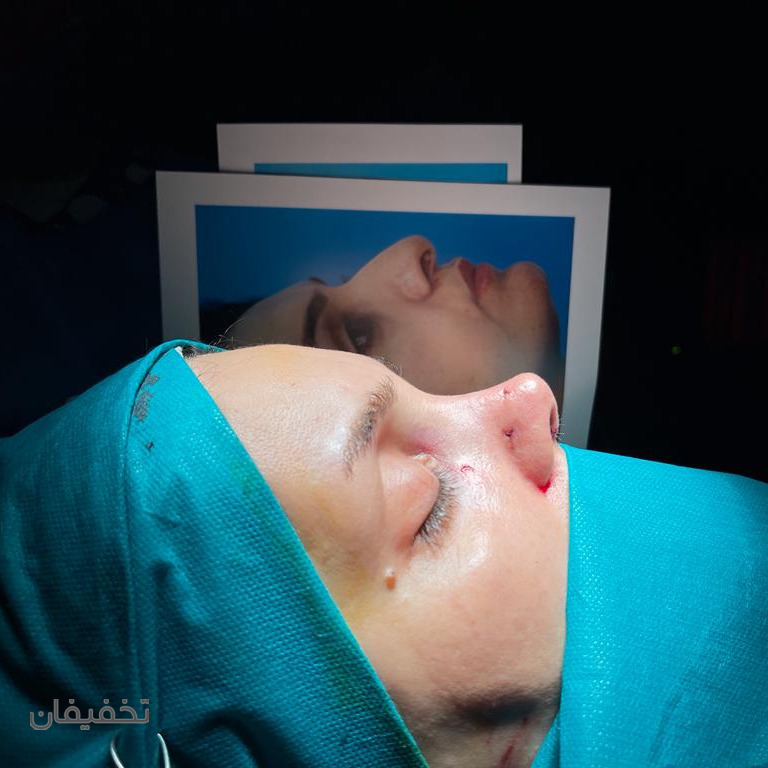 مطب زیبایی دکتر تابش