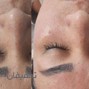 مرکز پوست و پاکسازی ماهلین