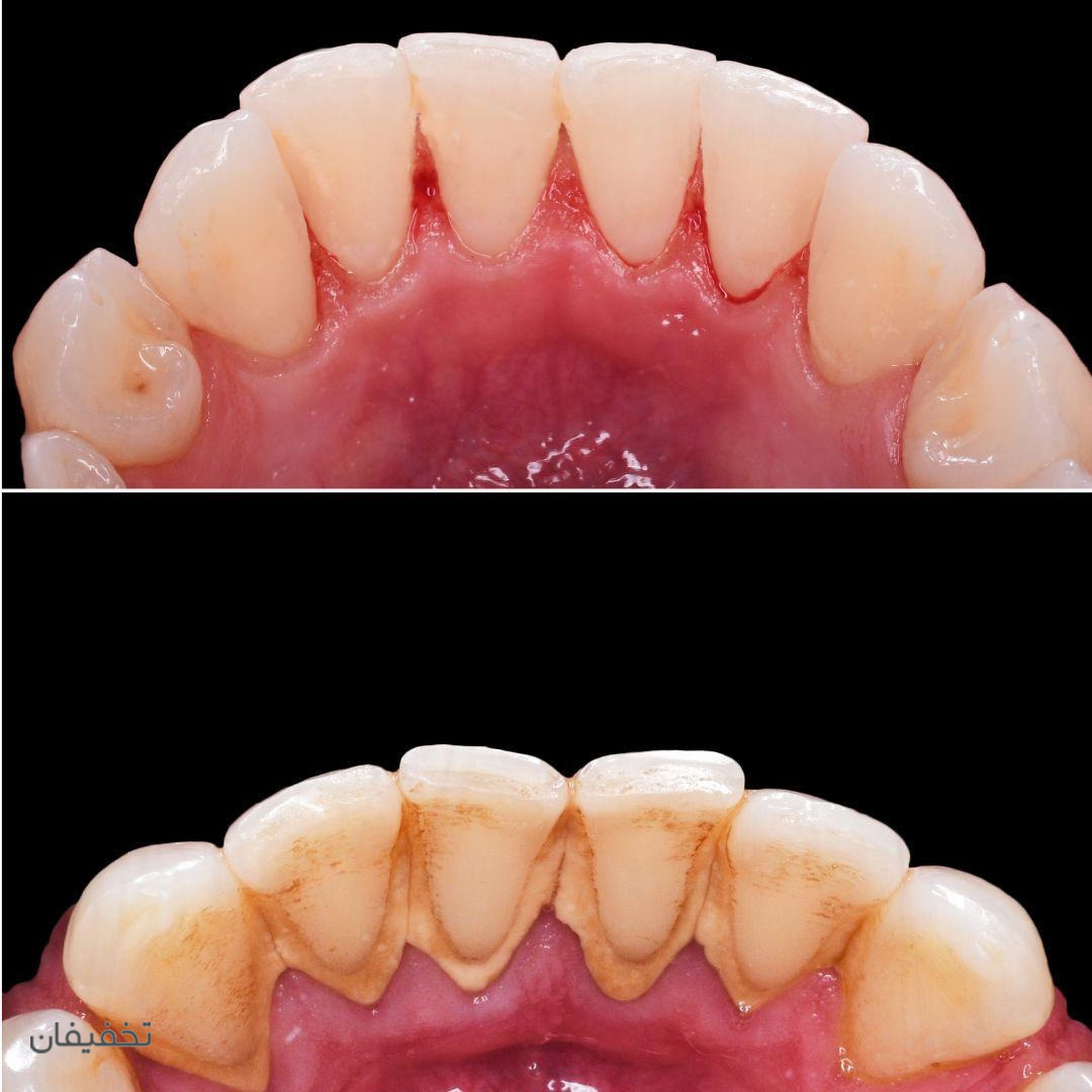 دندانپزشکی لوکا سعادت‌آباد