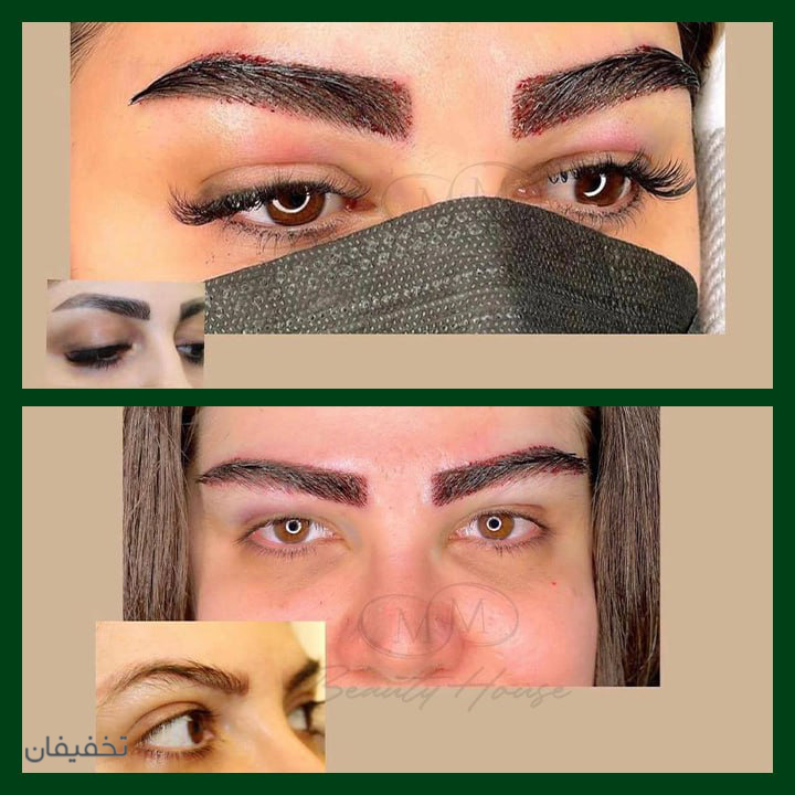 مطب زیبایی ماندگار