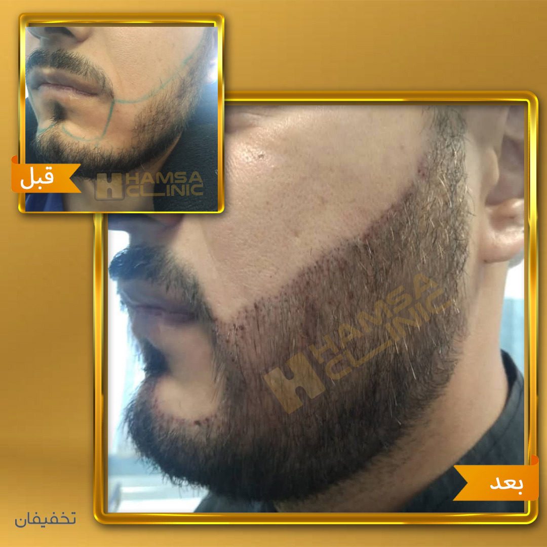 کلینیک کاشت مو و زیبایی همسا