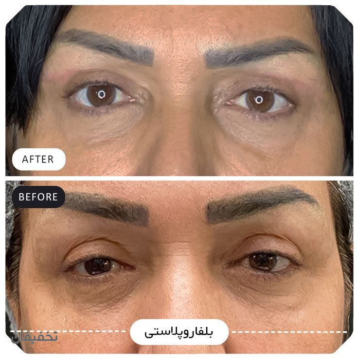 کلینیک زیبایی پوست و مو شاین