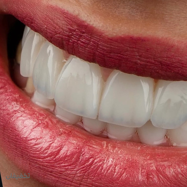مطب دندانپزشکی و زیبایی دکتر پریا سرحانی