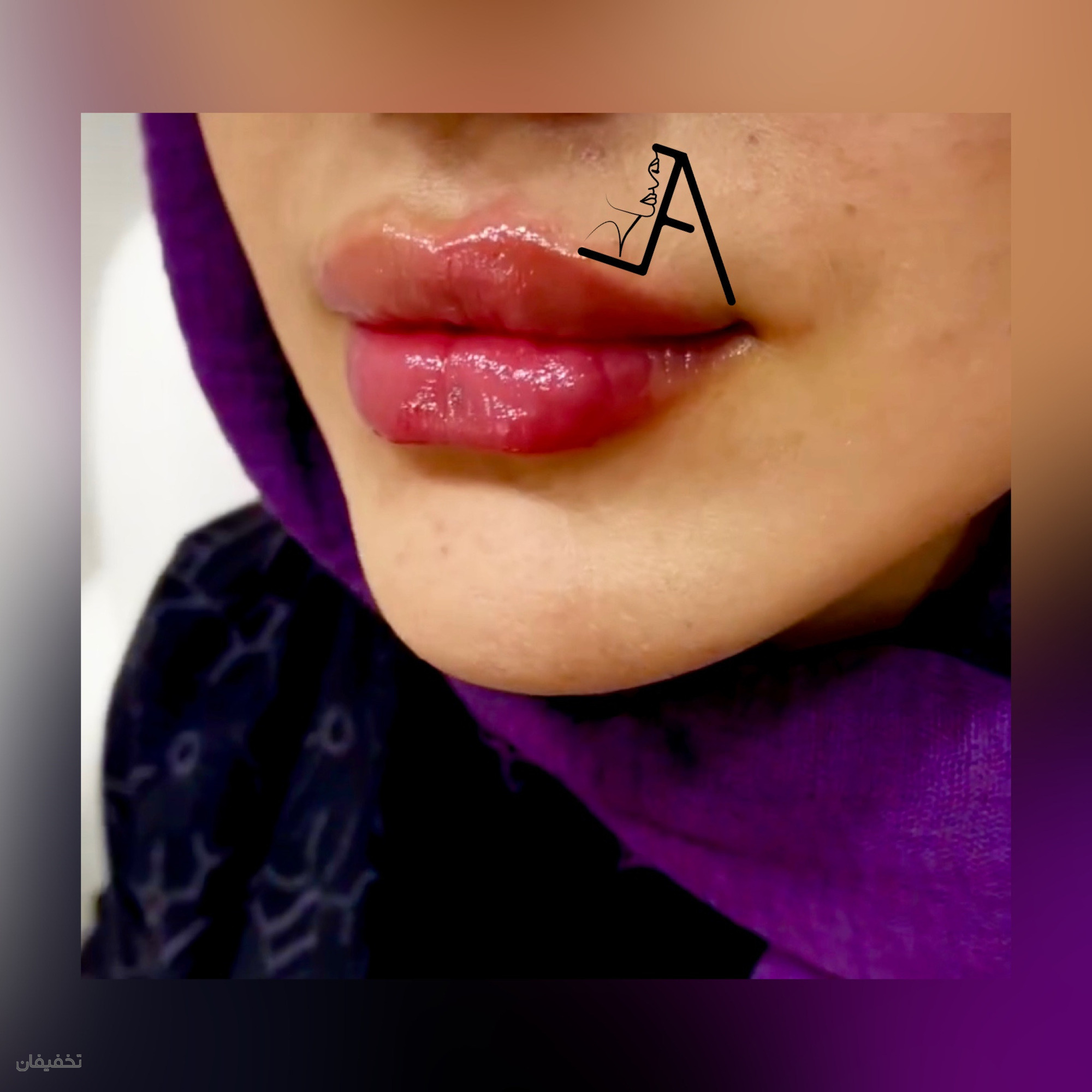 مرکز پوست،مو و زیبایی سحر