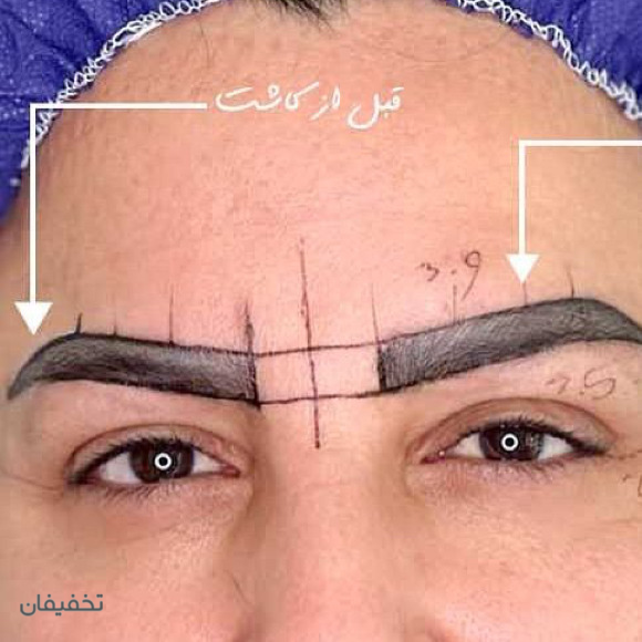 کلینیک زیبایی پوست و مو شاین