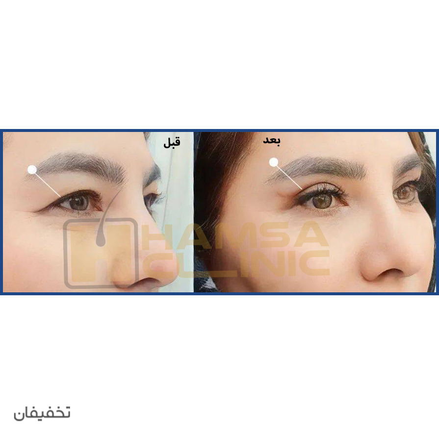 کلینیک کاشت مو و زیبایی همسا