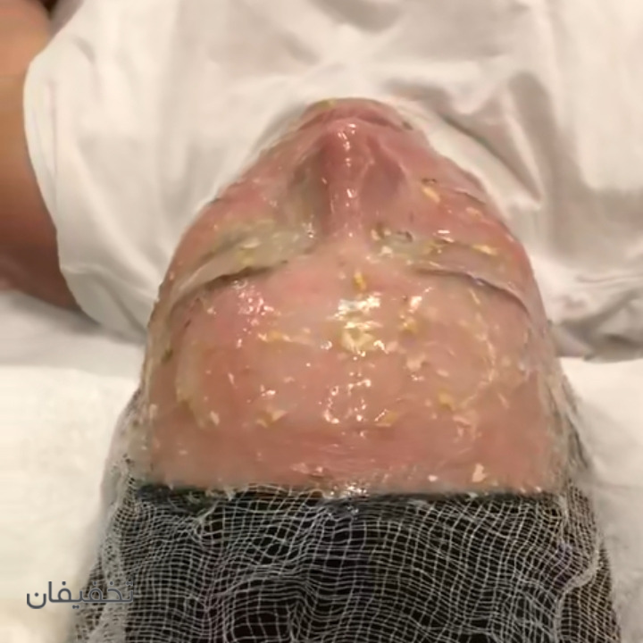 مرکز پوست و زیبایی نیکچهر