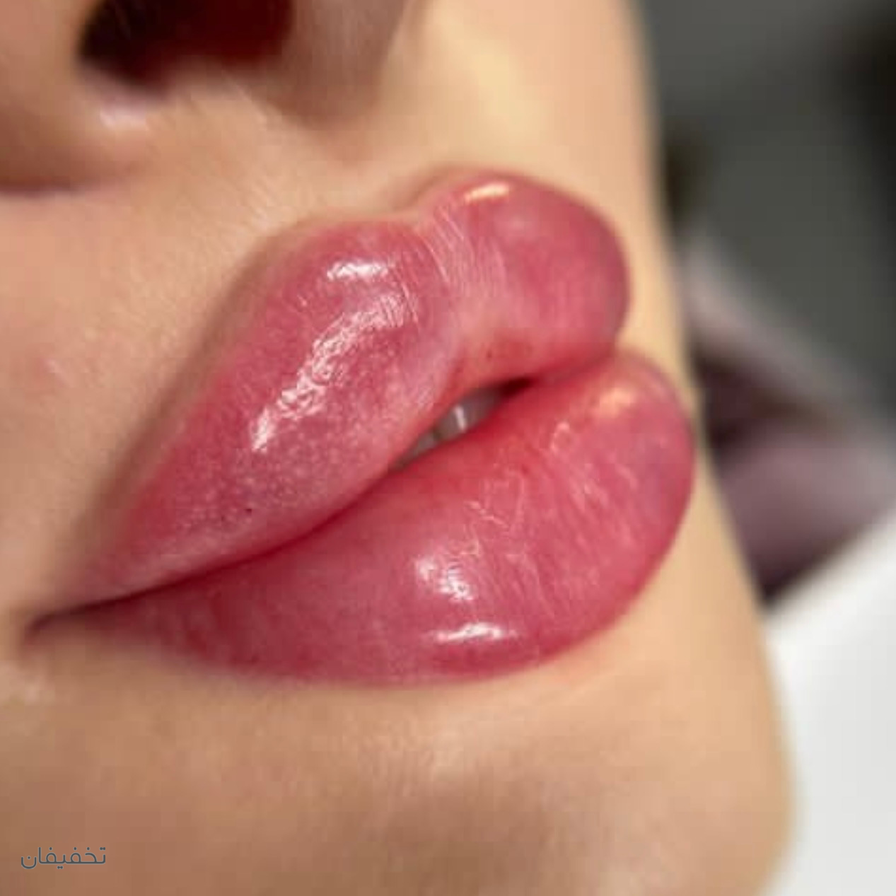 مطب پوست،مو و زیبایی خانم دکتر سحر باقری(شعبه نازی آباد)