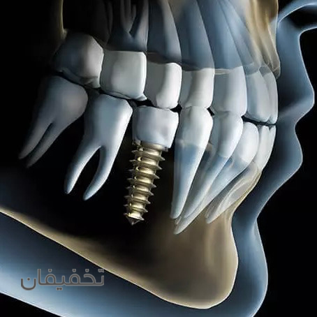دندانپزشکی الماس