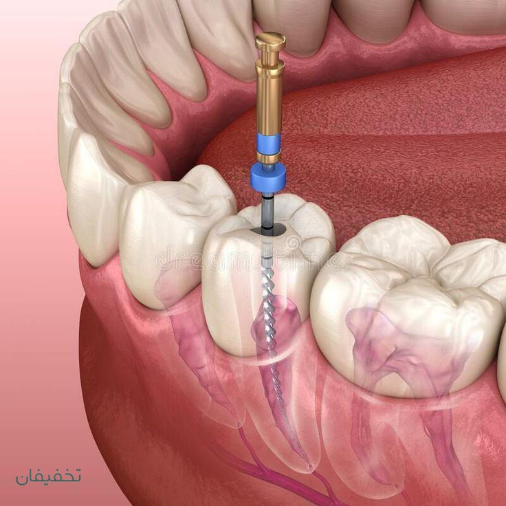 دندانپزشکی لوکا سعادت‌آباد