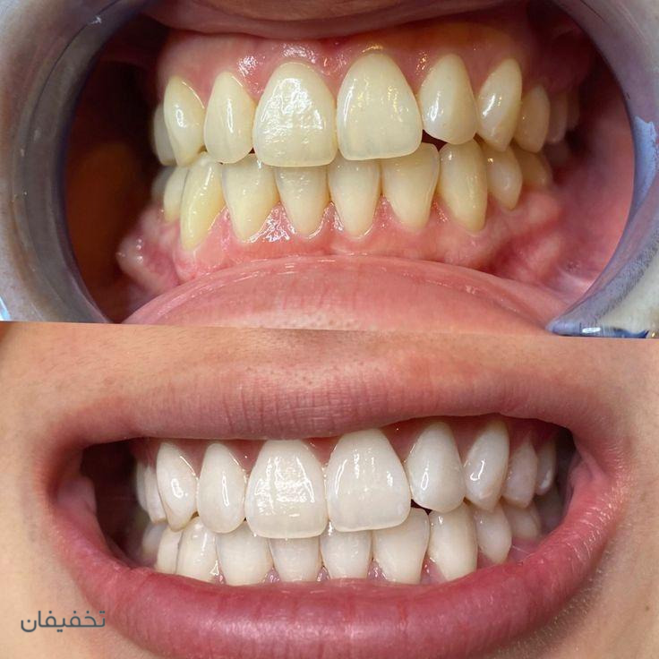 دندانپزشکی لوکا سعادت‌آباد