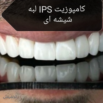 مطب دندانپزشکی دکتر نسا هاشمی